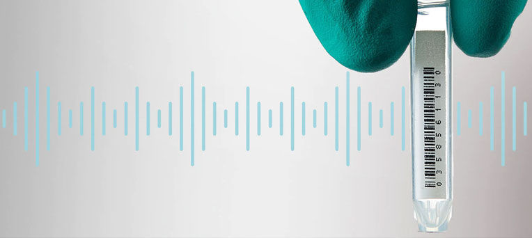 line out可以接音响吗